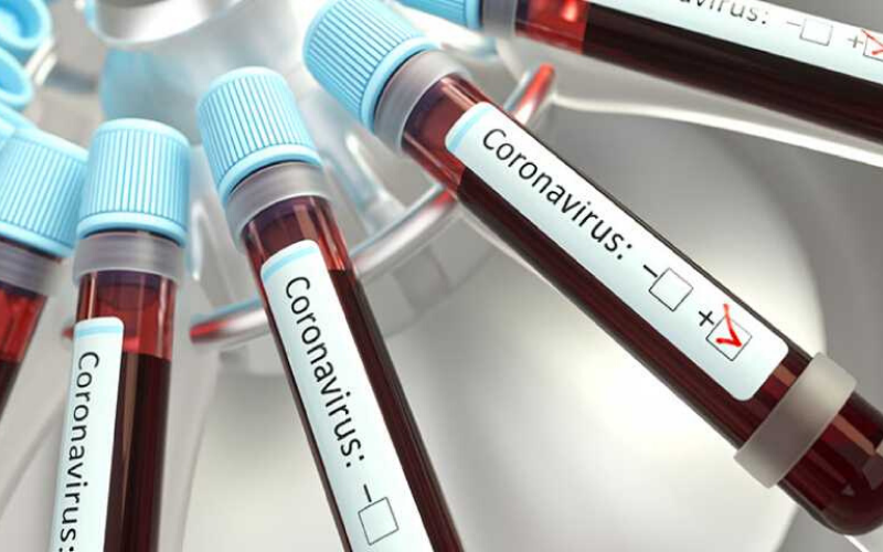 A la baja nuevos casos de coronavirus en China